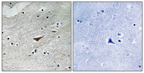 VE-Cadherin (Phospho-Tyr731) Antibody