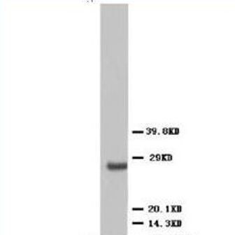 Anti-VEGF/VEGFA Antibody