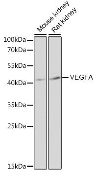 VEGF antibody