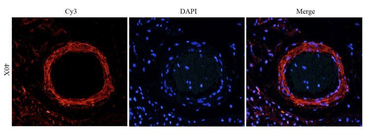 VEGF165 antibody