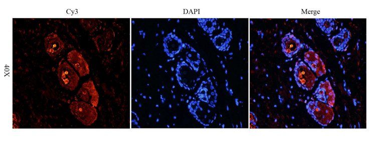 VEGF165 antibody