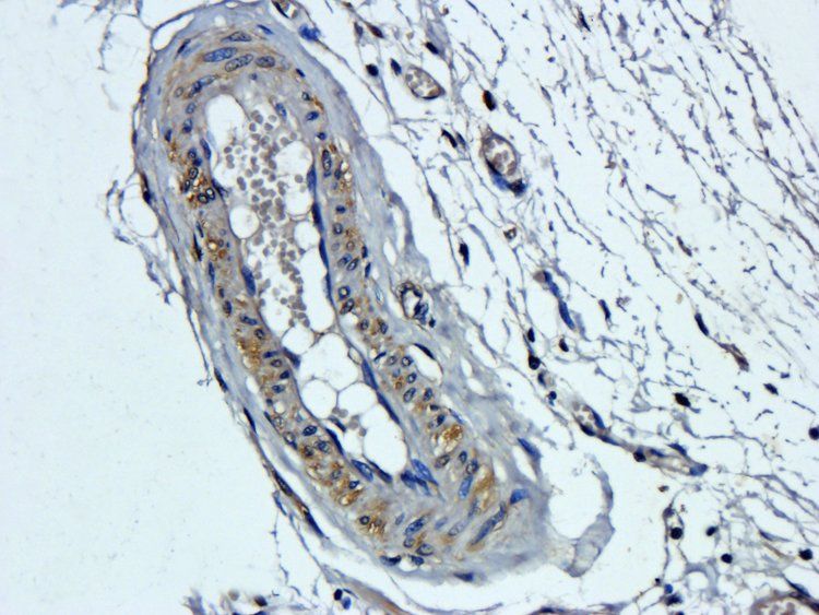 VEGF165 antibody