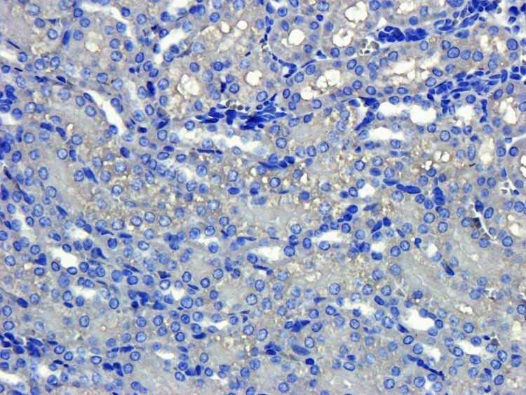 VEGF165 antibody