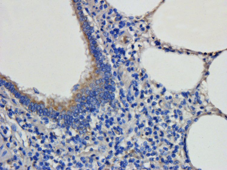 VEGF165 antibody