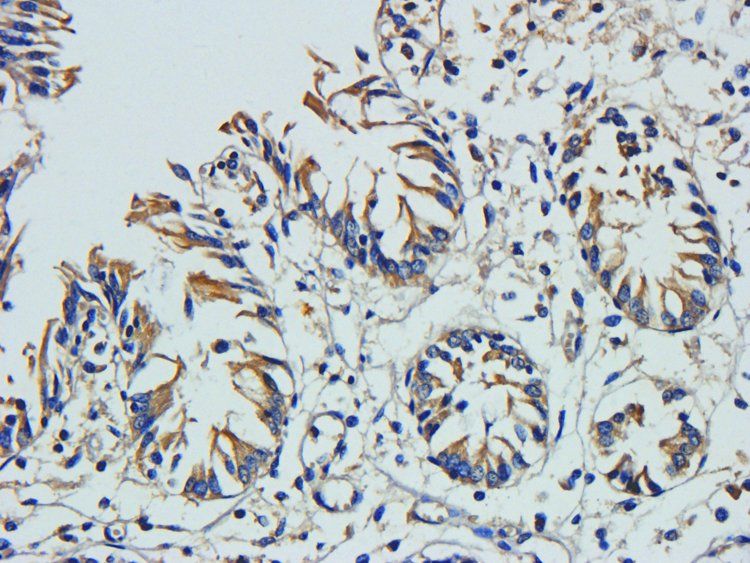 VEGF165 antibody