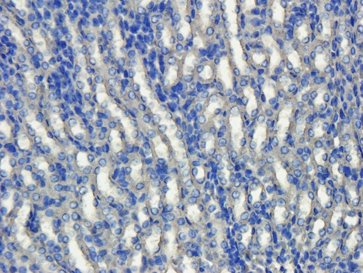 VEGF165 antibody