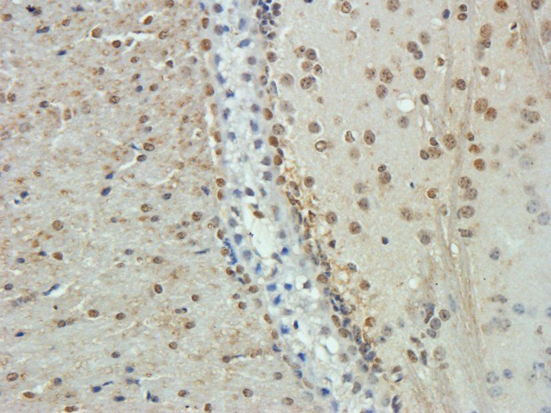 VEGF antibody