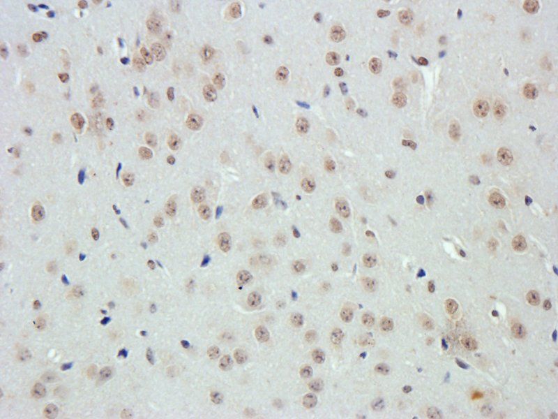 VEGF antibody