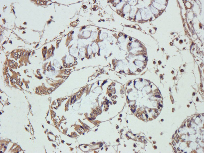 VEGF antibody