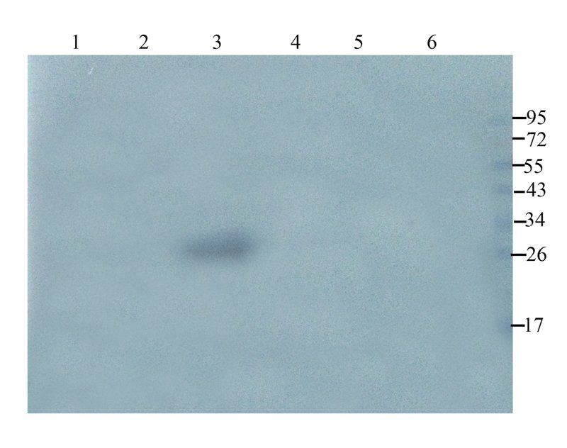 VEGF antibody