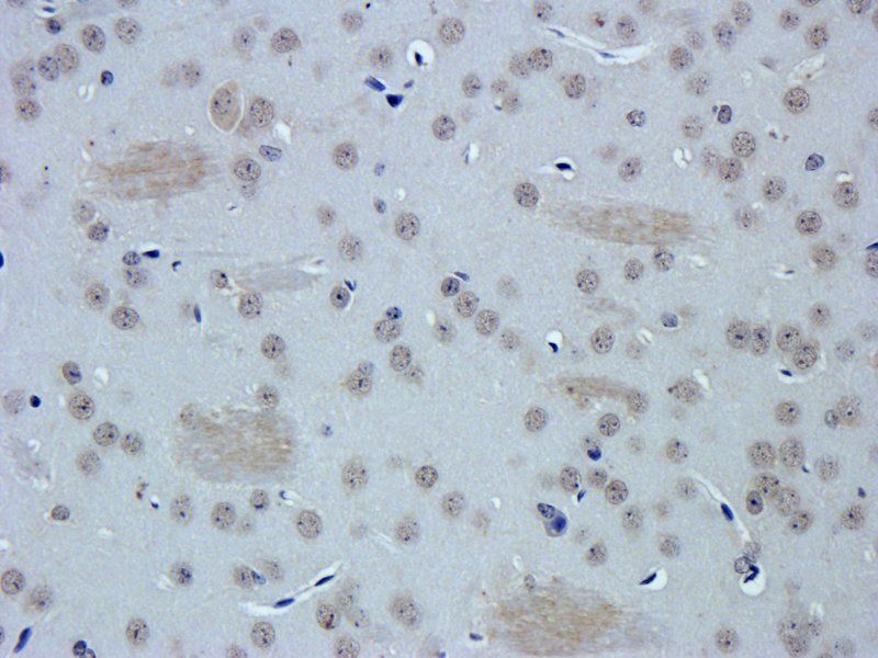 VEGF antibody