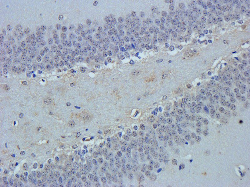 VEGF antibody