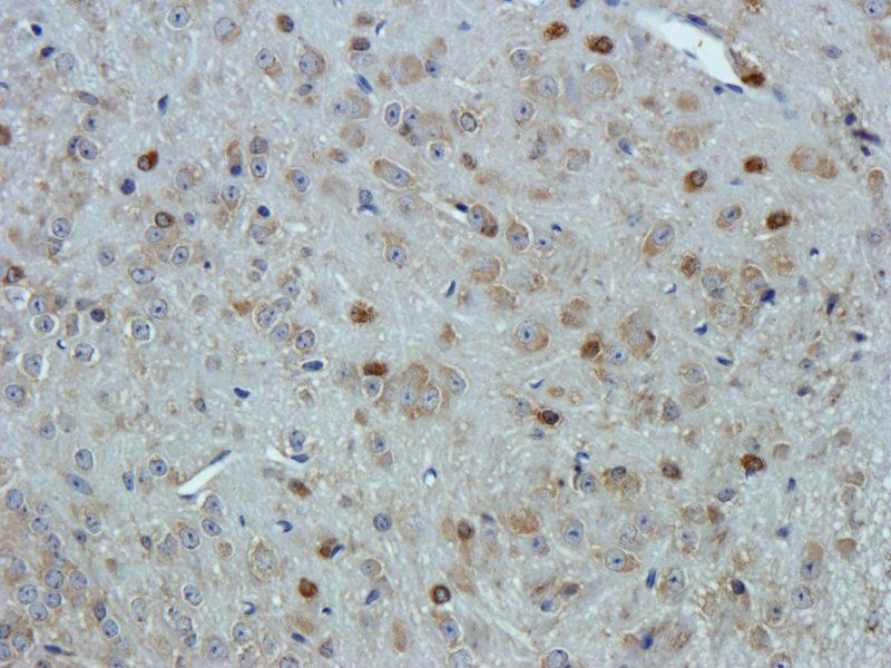 VEGF antibody