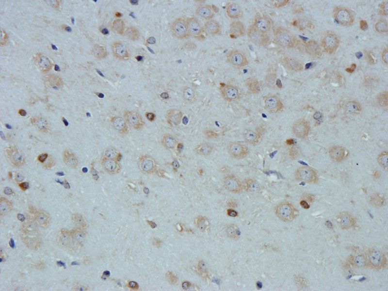 VEGF antibody