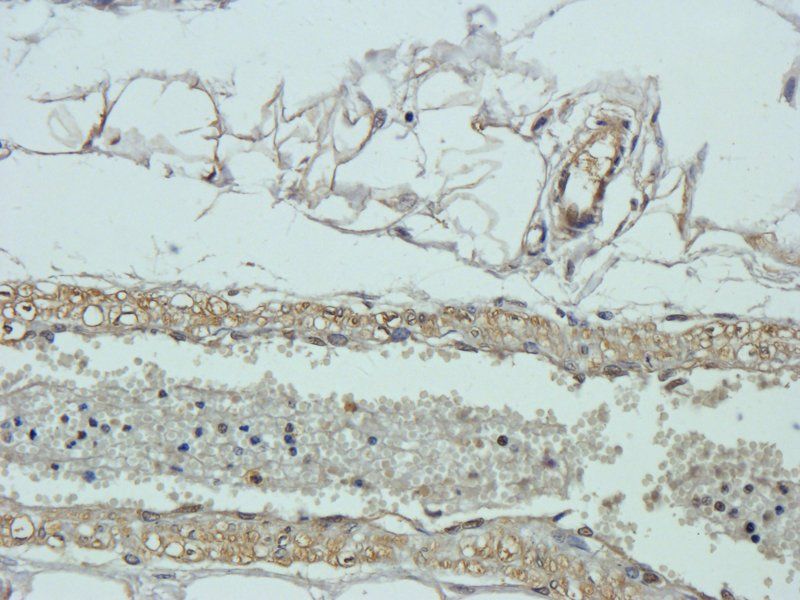 VEGF antibody