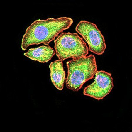 VEGFA Antibody