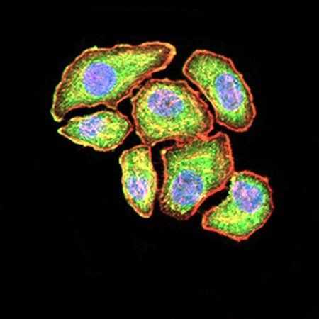 VEGFA Antibody