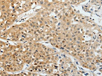 VEGFA Antibody
