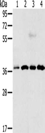 VEGFA Antibody