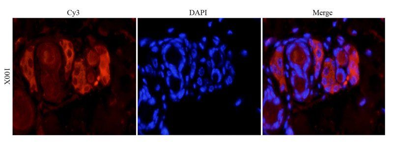 VEGF antibody