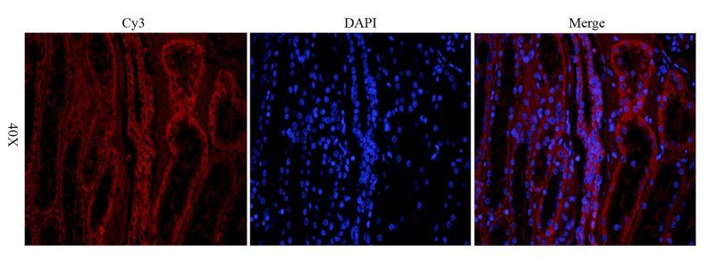 VEGF antibody