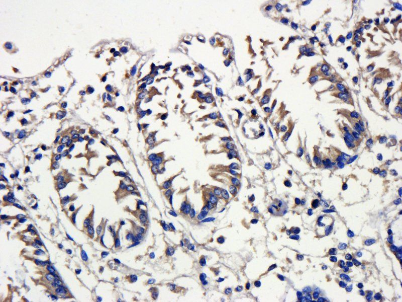 VEGF antibody