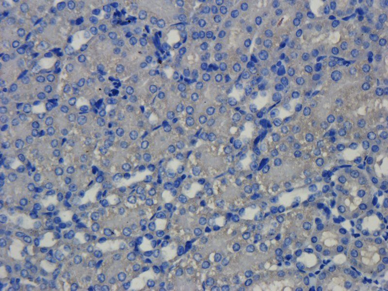 VEGF antibody