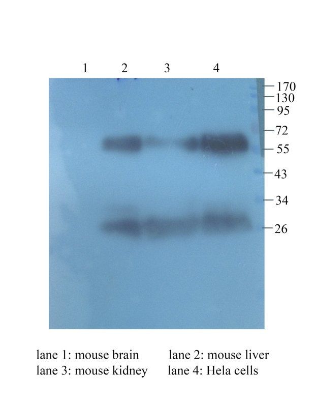 VEGF antibody