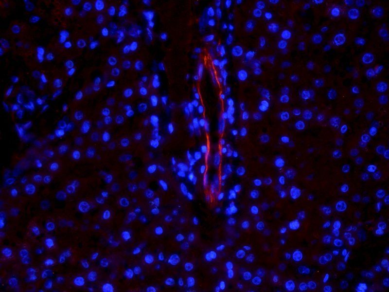 VEGFR2 antibody