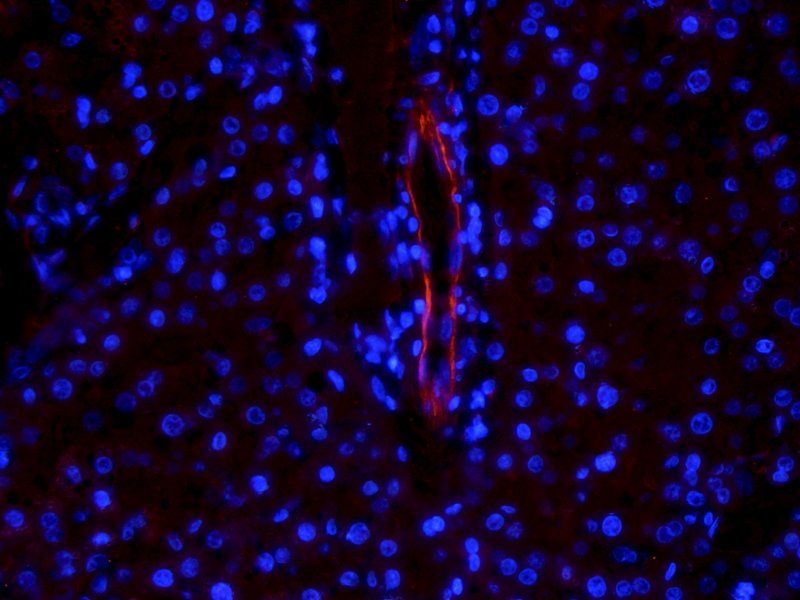 VEGFR2 antibody