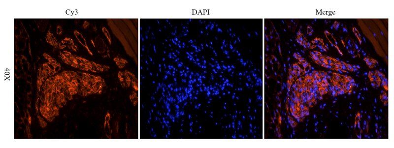 VEGFR2 antibody