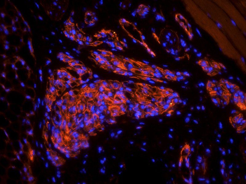 VEGFR2 antibody