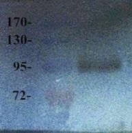 VEGFR2 antibody