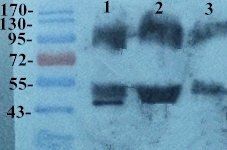 VEGFR2 antibody