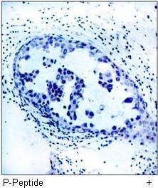 VEGFR2 (Phospho-Tyr1175) Antibody