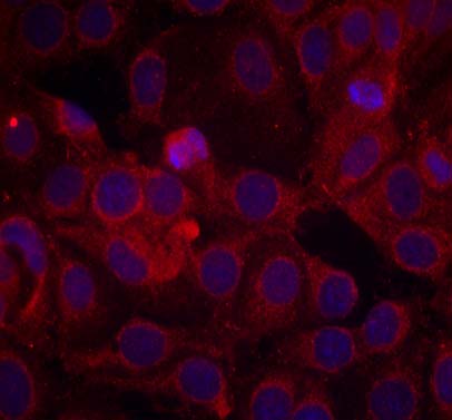 VEGFR2 (Phospho-Tyr1175) Antibody