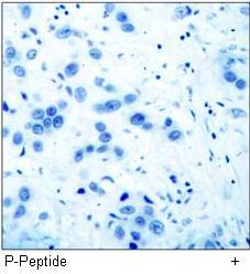 VEGFR2 (Phospho-Tyr951) Antibody