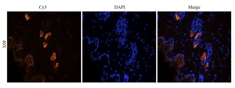 VEGFR3 antibody