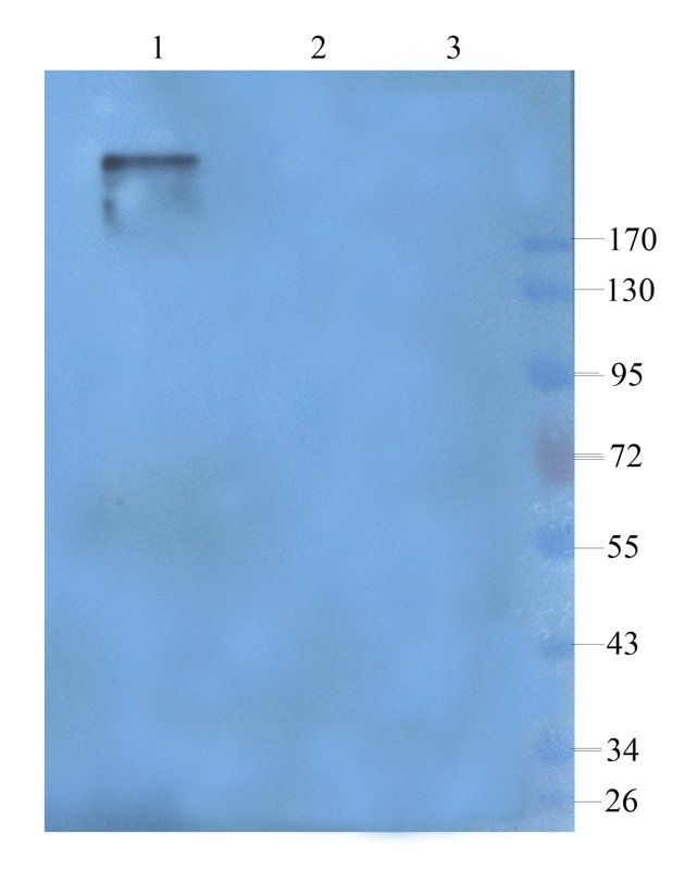 VEGFR3 antibody