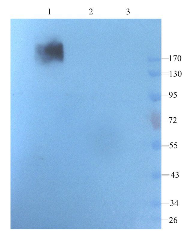 VEGFR3 antibody