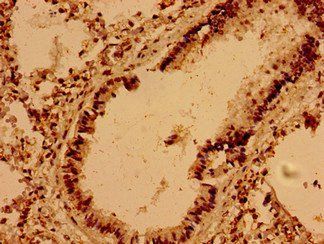 VAMP7 Antibody