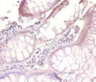 VAMP7 Antibody