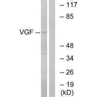 VGF antibody
