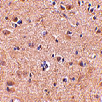 VGF Rabbit Polyclonal Antibody