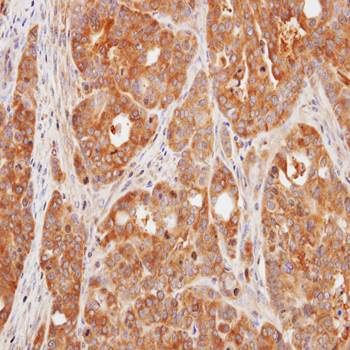 VHR antibody