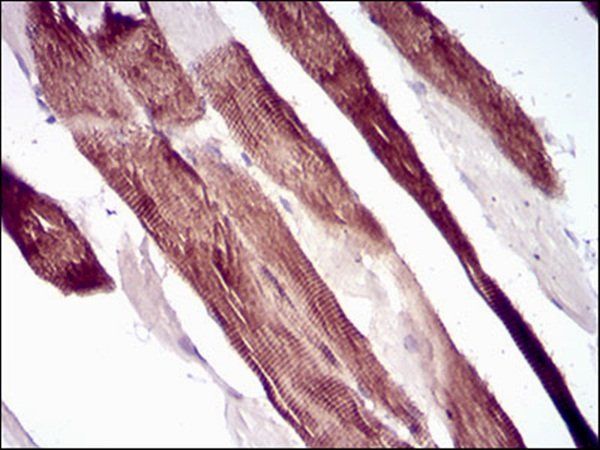 VIL1 Antibody