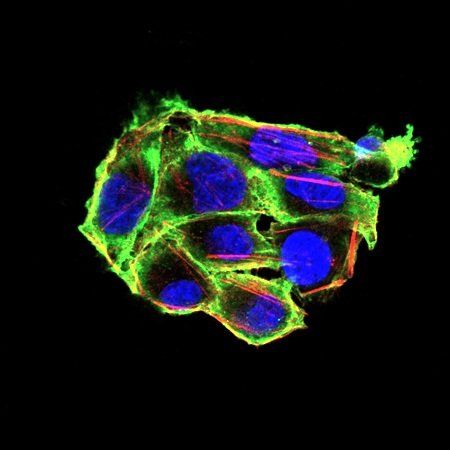 VIL1 Antibody