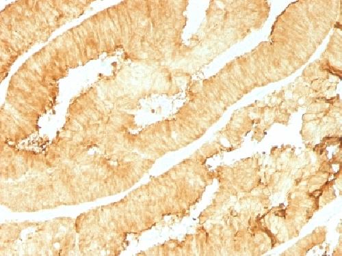 Villin (GI-Mucosal & Urogenital Brush Border Marker) Antibody