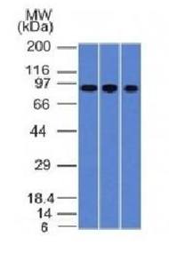 Villin (GI-Mucosal & Urogenital Brush Border Marker) Antibody