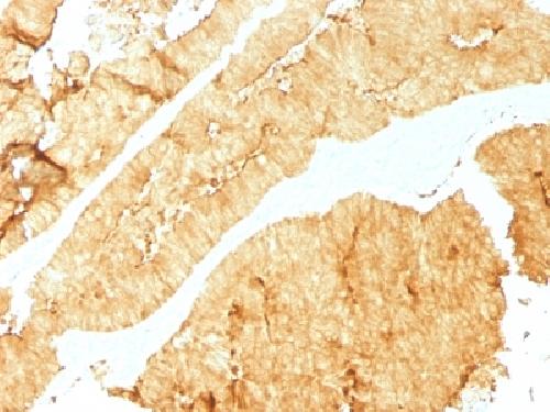 Villin (GI-Mucosal & Urogenital Brush Border Marker) Antibody